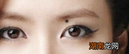 脸上长痣怎么去掉