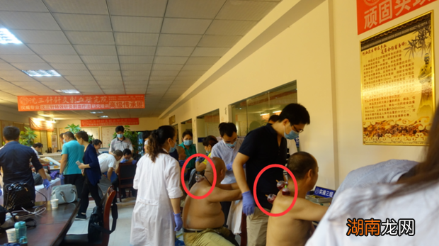 背部中医刺络放血疗法