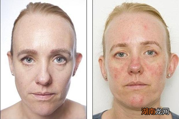 加速肌肤老化的不良习惯