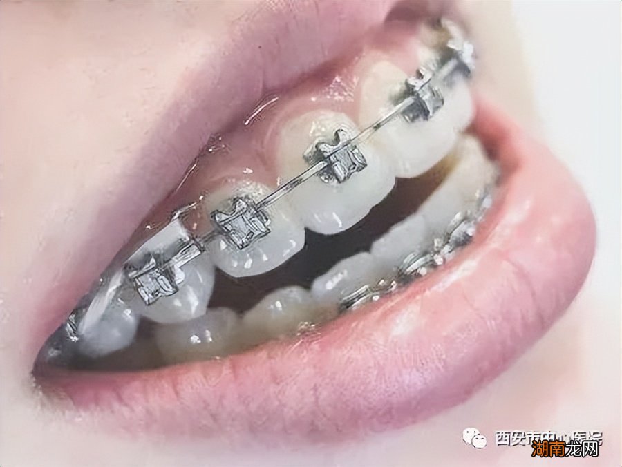 18岁男生怎么最快最有效的变帅气 如何让自己变帅