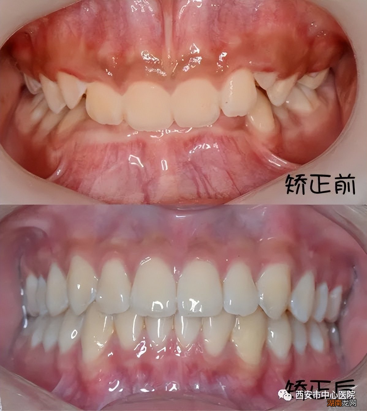 18岁男生怎么最快最有效的变帅气 如何让自己变帅