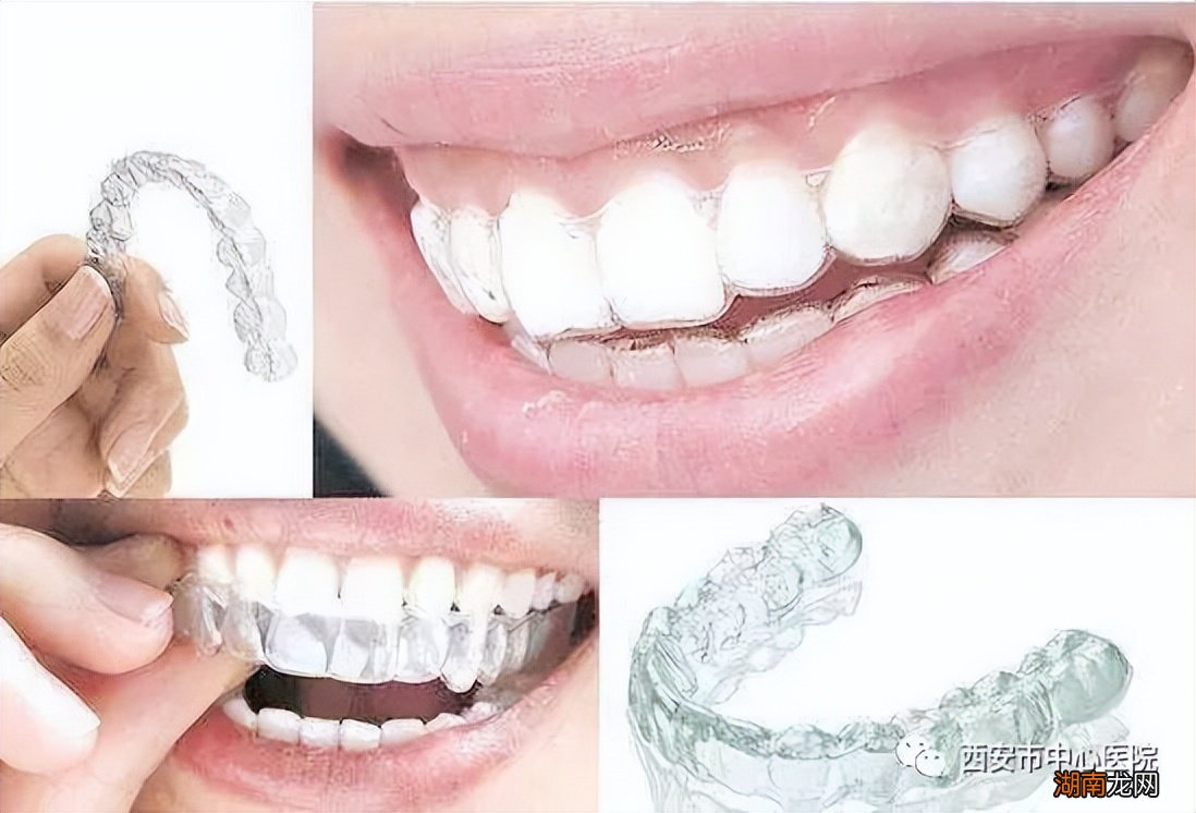 18岁男生怎么最快最有效的变帅气 如何让自己变帅