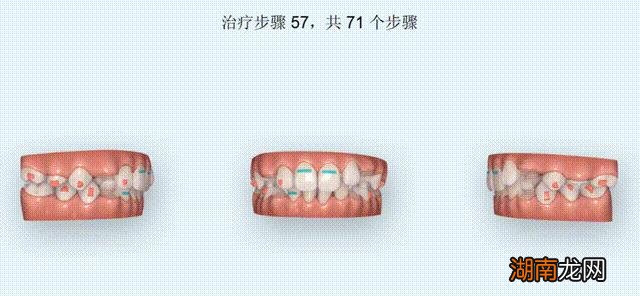 18岁男生怎么最快最有效的变帅气 如何让自己变帅