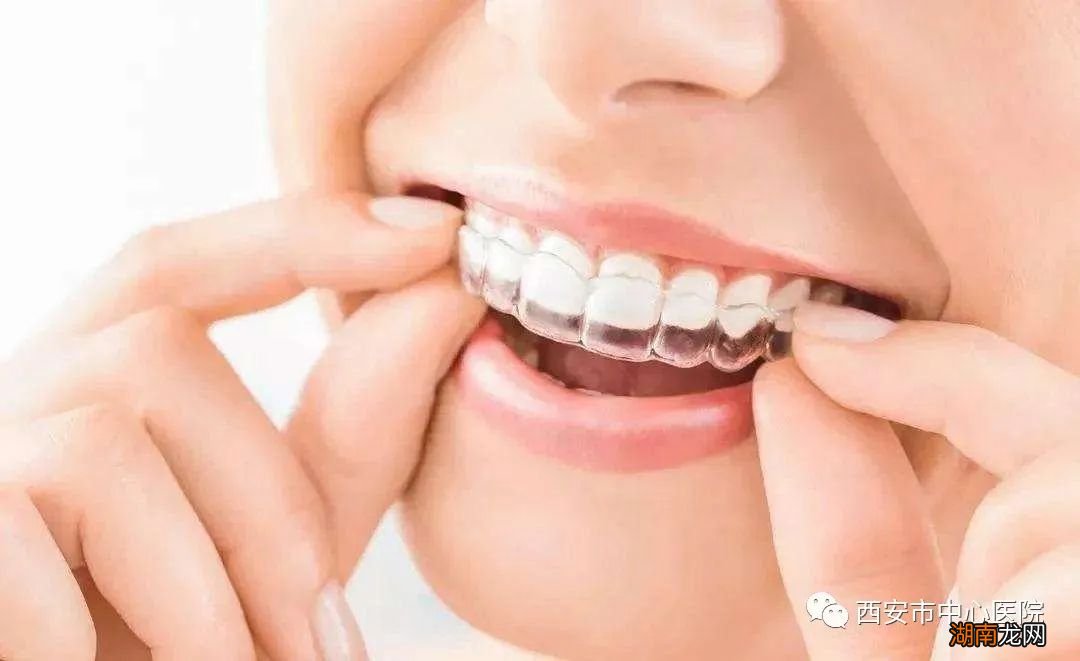 18岁男生怎么最快最有效的变帅气 如何让自己变帅