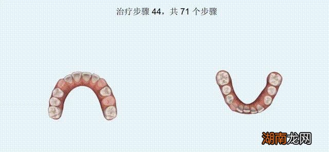 18岁男生怎么最快最有效的变帅气 如何让自己变帅