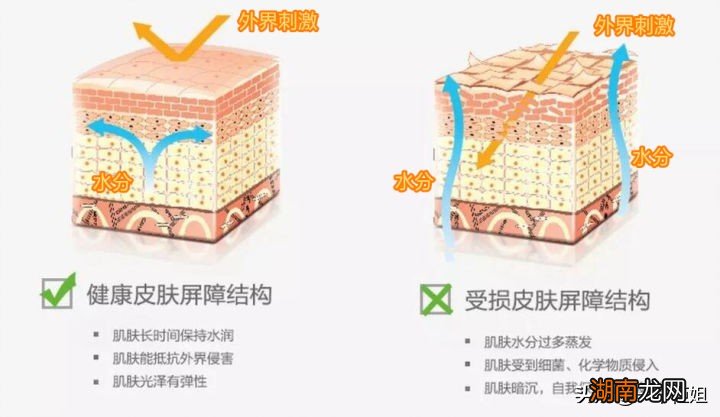 脸上起白皮的原因是什么 洗完脸后脸上起白皮怎么办