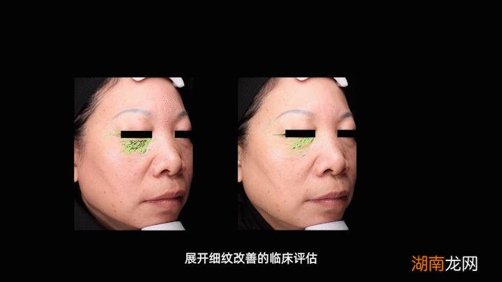 HBN销售额为何会爆发式增长 hbn护肤品是哪国的