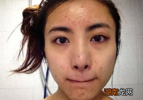 睡醒后脸上出油很厉害什么原因 睡醒后脸上出油是好还是坏