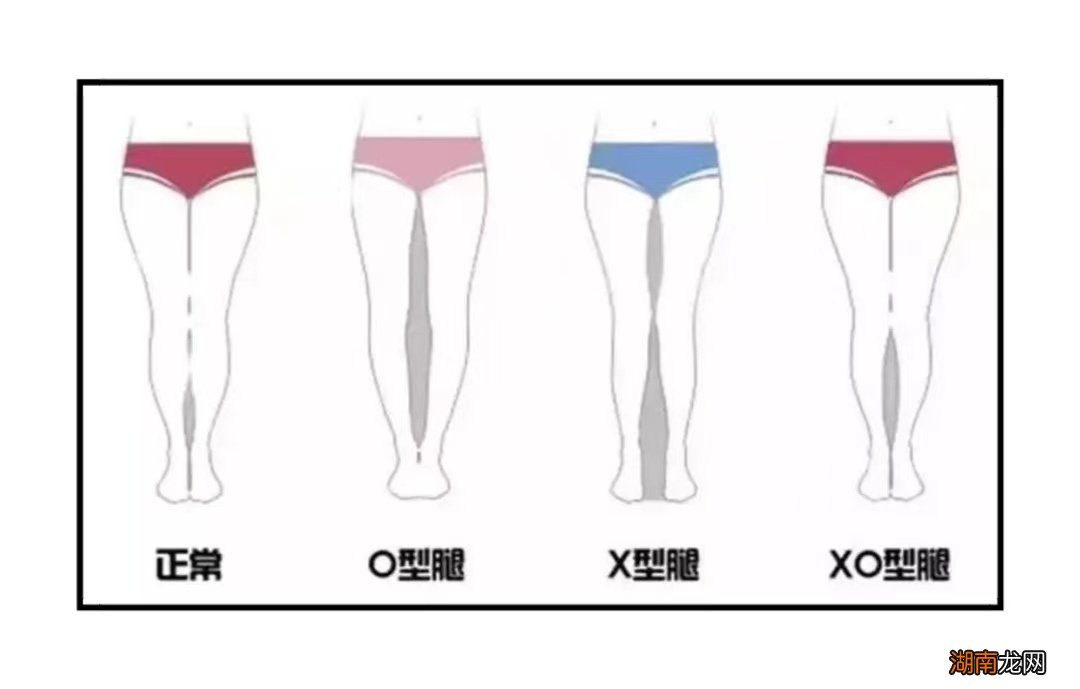 什么腿型穿鲨鱼裤搭配不尴尬又好看 什么是鲨鱼裤