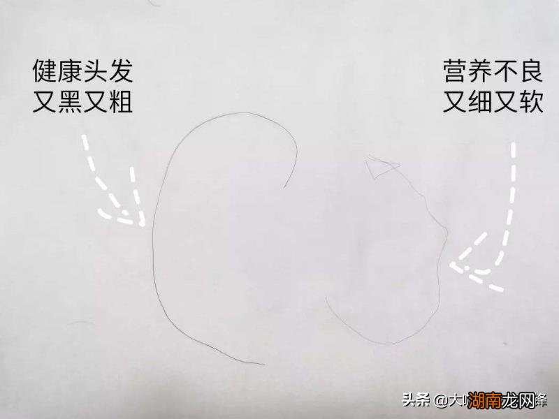 头发细软并且量还少原因及改善方法 头发软又细又少怎么办