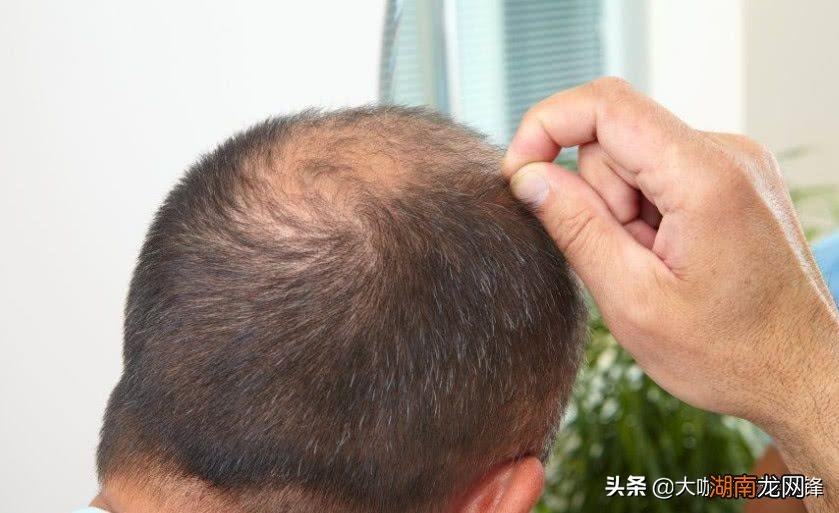 头发细软并且量还少原因及改善方法 头发软又细又少怎么办