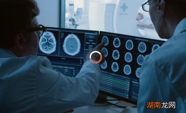 人工智能现在可以阅读瘫痪患者的想象 就像他们想象的那样