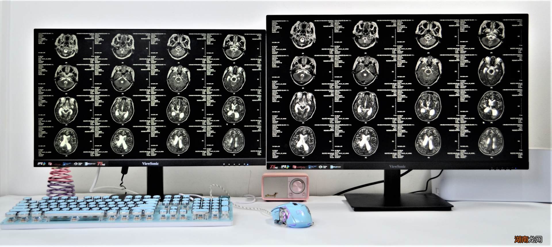 两种尺寸屏幕实物对比 27寸屏和24寸图片对比如何