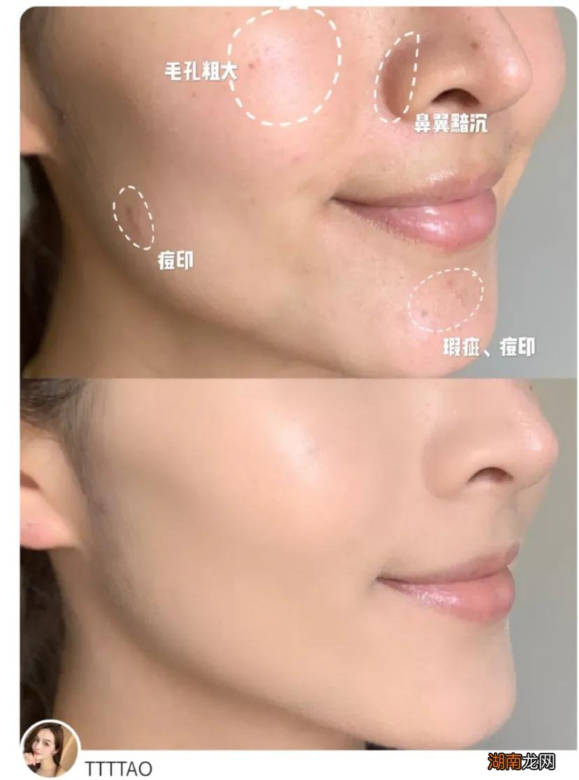 粉底液和气垫哪个好用 建议买气垫还是粉底液对皮肤好