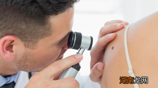 深度学习可改善2个广泛患者群体的皮肤病学诊断