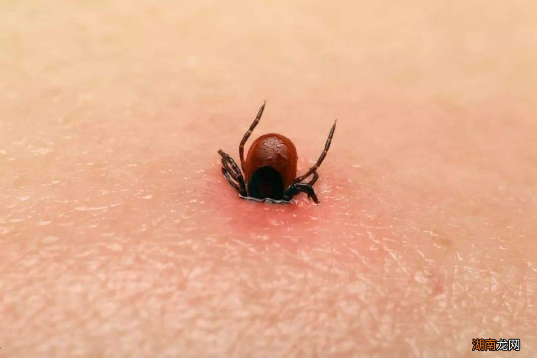 为什么狗身上会有蜱虫 狗身上蜱虫会跑到人身上吗