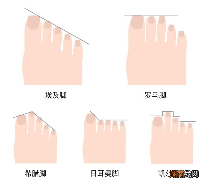 脚趾长度分为哪几种 第二个脚趾头比第一个长的寓意