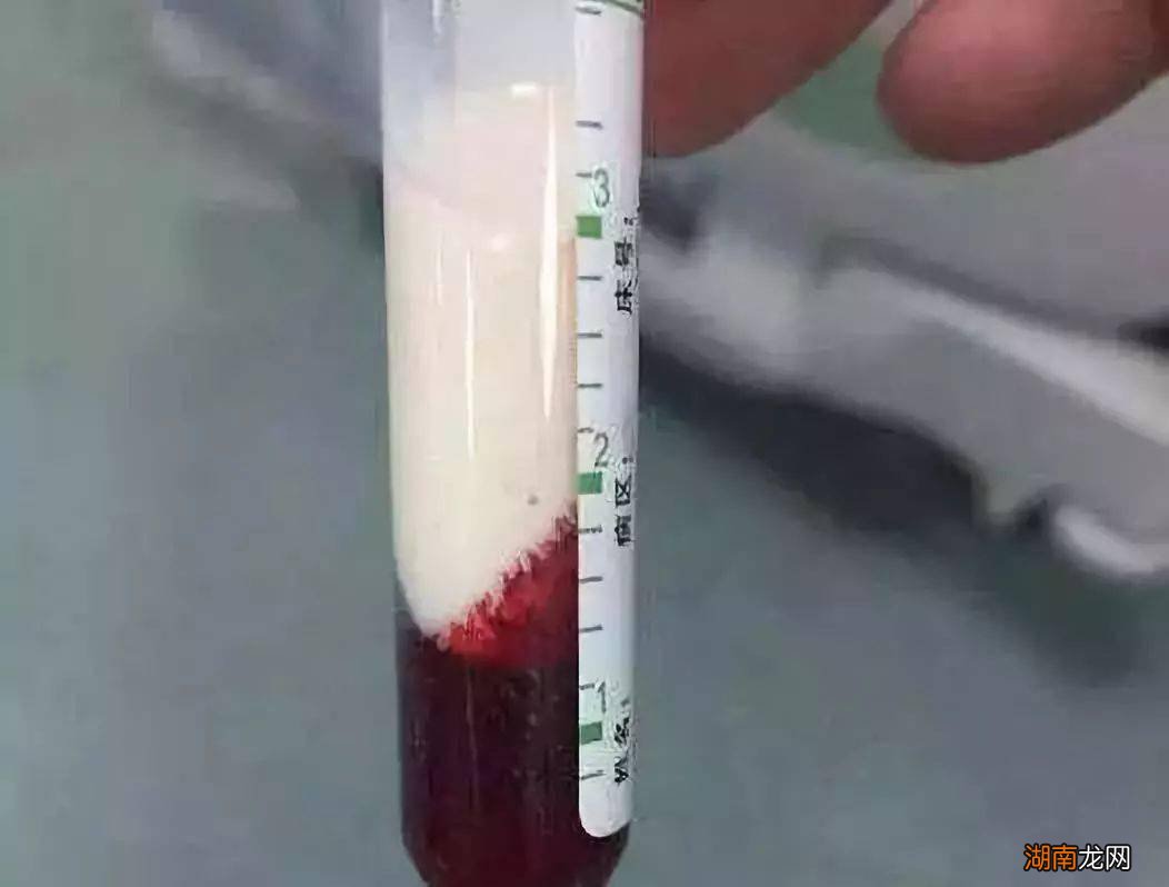 为什么致死率却是0 内陆太攀蛇是世界上最毒的蛇吗