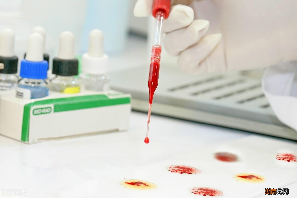 全球最稀有的几种血型介绍 世界上最稀有的血型排名