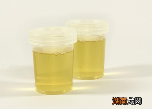 详解b2浇花作用及功能 维生素b2浇花什么好处和坏处