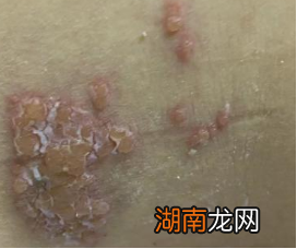 中国镇痛周丨关注疼痛，一起对疼痛说再见