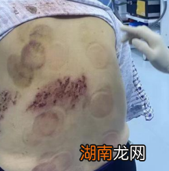 中国镇痛周丨关注疼痛，一起对疼痛说再见