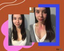 喝酒上脸！“亚洲红”到底是不是进化“缺陷”？