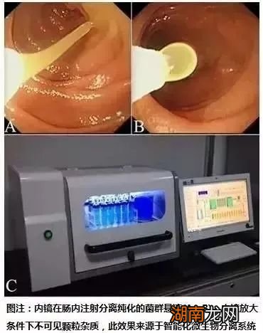 粪便治病科技:一场人体微生物的“奇妙冒险”!