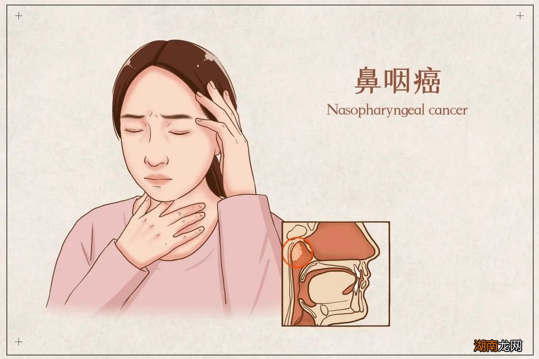 癌症到底该不该做放疗?害怕有辐射、掉头发?