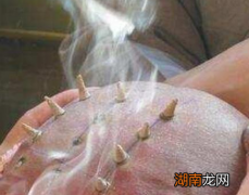 古代和尚为什么要烧戒疤 这东西真的是一排排的吗