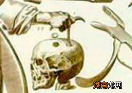 古代做手术真的不打麻药吗 这种说法是传说还是事实