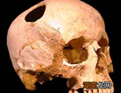 古代做手术真的不打麻药吗 这种说法是传说还是事实