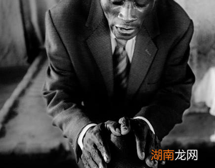 古代西医治疗到底有多奇葩 放血之前需要&amp;ldquo;算一卦&amp;rdquo;