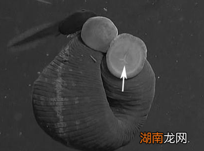 古代水蛭疗法揭秘 古人真的用吸血虫治病吗