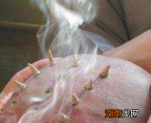 古代和尚为何要在头上烧戒疤 其实里面是有故事的