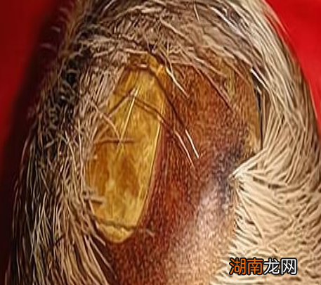 古代有无痛人流吗 古人一般都用什么方式流产